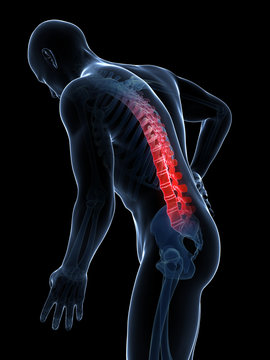 3d rendered illustration - backache male