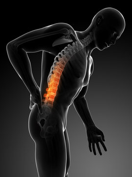 3d rendered illustration - backache male