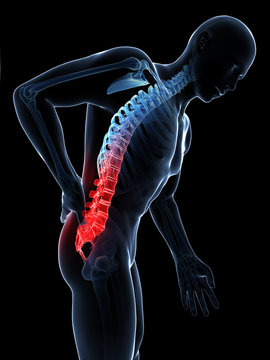 3d rendered illustration - backache male