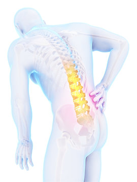 3d rendered illustration - backache male
