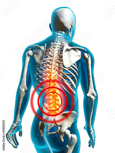 Fotografía human back pain rückenschmerzen freisteller