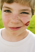 Grimacing Boy With Lipstick Kiss On Face