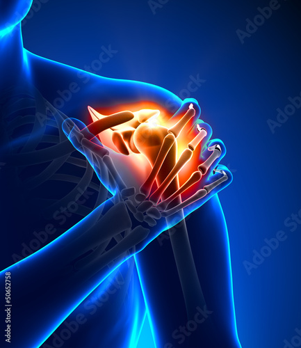 Naklejka - mata magnetyczna na lodówkę Shoulder pain - detail