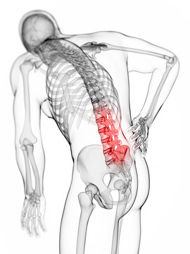3d rendered illustration - backache male