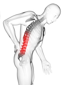 3d rendered illustration - backache male
