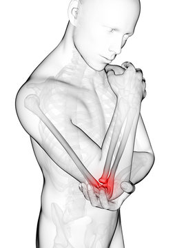 3d rendered illustration of pain in the elbow