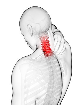 3d rendered illustration - painful neck