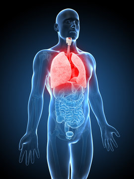 3d rendered illustration of an inflamed lung