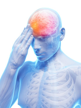 3d rendered conceptual illustration of head pain