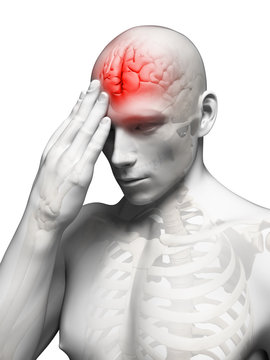 3d rendered conceptual illustration of head pain