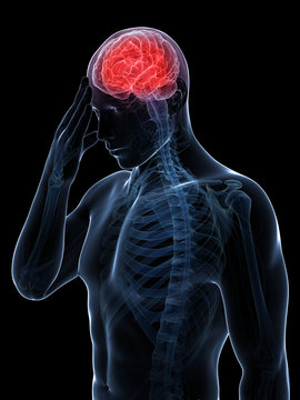 3d rendered conceptual illustration of head pain