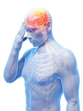 3d rendered conceptual illustration of head pain