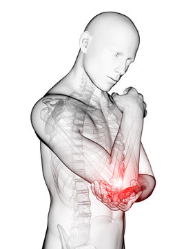 3d rendered medical illustration - painful elbow