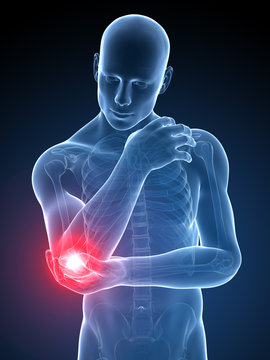 3d rendered medical illustration - painful elbow