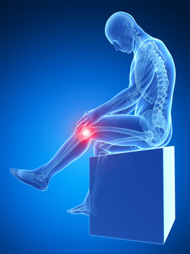 3d rendered medical illustration - painful knee