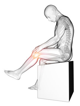 3d rendered medical illustration - painful knee
