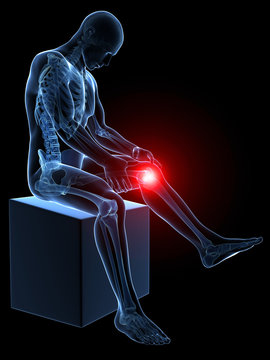 3d rendered medical illustration - painful knee