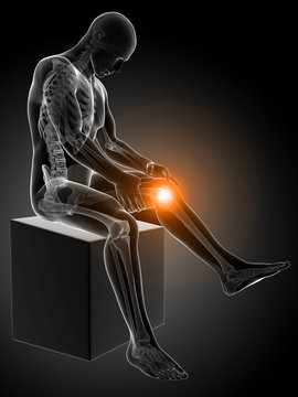 3d rendered medical illustration - painful knee