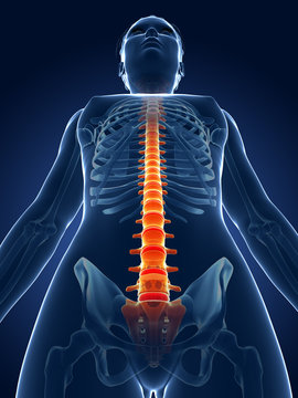 3d rendered medical illustration - painful spine