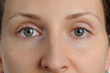 © Udo Kroener - Augenpaar einer laechelnden jungen,bruenetten Frau.