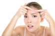 Acne spot pimple - skin care girl and skin problem
