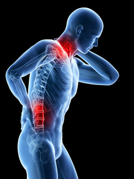 3d rendered illustration of a man having a painful back and neck