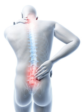 3d rendered illustration of a man having a painful back and neck