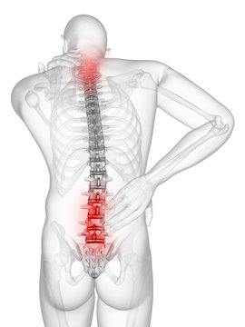 3d rendered illustration of a man having a painful back and neck