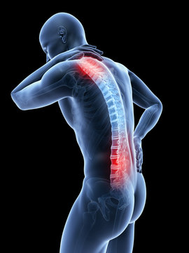 3d rendered illustration of a man having a painful back and neck
