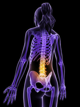 3d rendered illustration of a female having backache