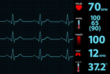 Modern Electrocardiogram Monitor Display