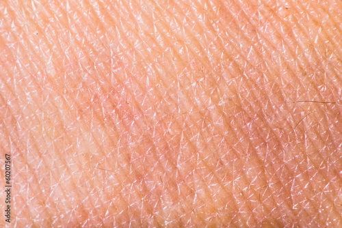 Fotografia, Obraz  Texture of human skin