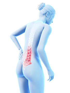 3d rendered medical illustration - Acute pain in a woman´s back.