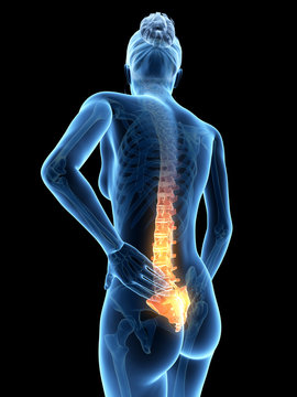 3d rendered medical illustration - Acute pain in a woman´s back.