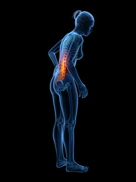3d rendered medical illustration - Acute pain in a woman´s back.