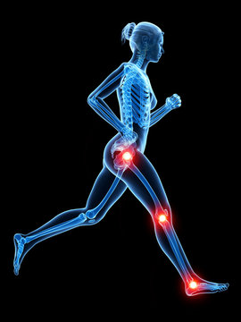 3d rendered illustration - painful joggers joints