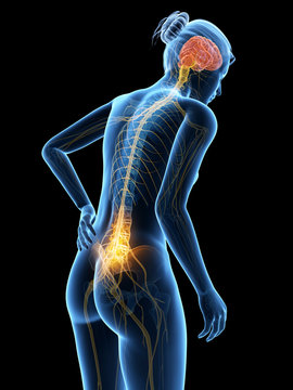 3d rendered illustration - woman having acute pain in the back