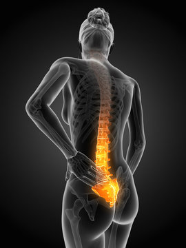 3d rendered illustration - woman having acute pain in the back