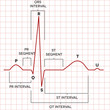 © reineg - Human heart normal sinus rhythm, electrocardiogram
