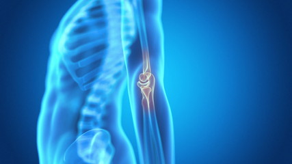 Wall Mural - medical animation - pain in the elbow