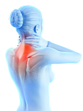 medical 3d illustration - woman having a painful neck