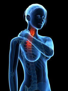 medical 3d illustration - woman having a painful neck