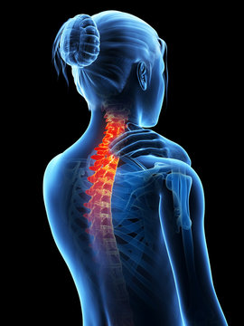 medical 3d illustration - woman having a painful neck