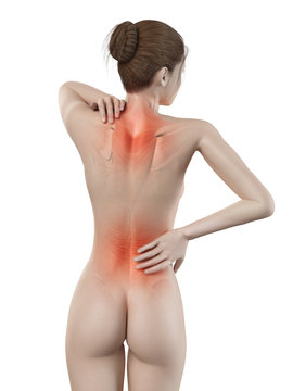 medical 3d illustration - female having backache