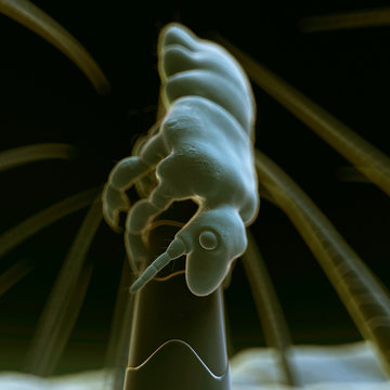medical 3d illustration - head louse