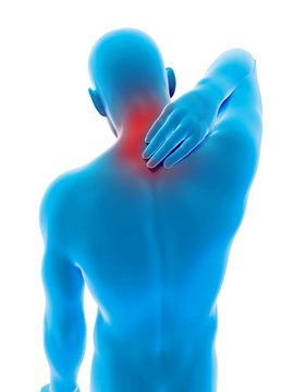 medical 3d illustration - male having pain in the neck