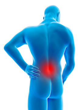 medical 3d illustration - male having backache