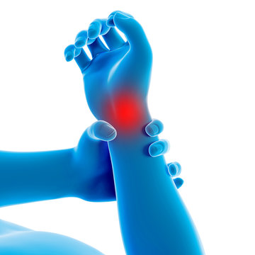 medical 3d illustration - man having a painful wrist