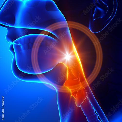 Cuadros en Lienzo Sore throat - Flu / Cold / Stuck throat