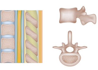 Canvas Print - Human spine, vertebral bones and intervertebral disks.